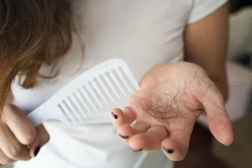 hair loss