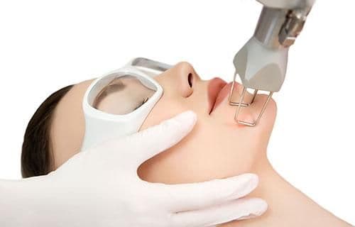fractional_co2_laser