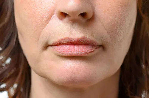 Aging Mouth and Lips The Process and Effects