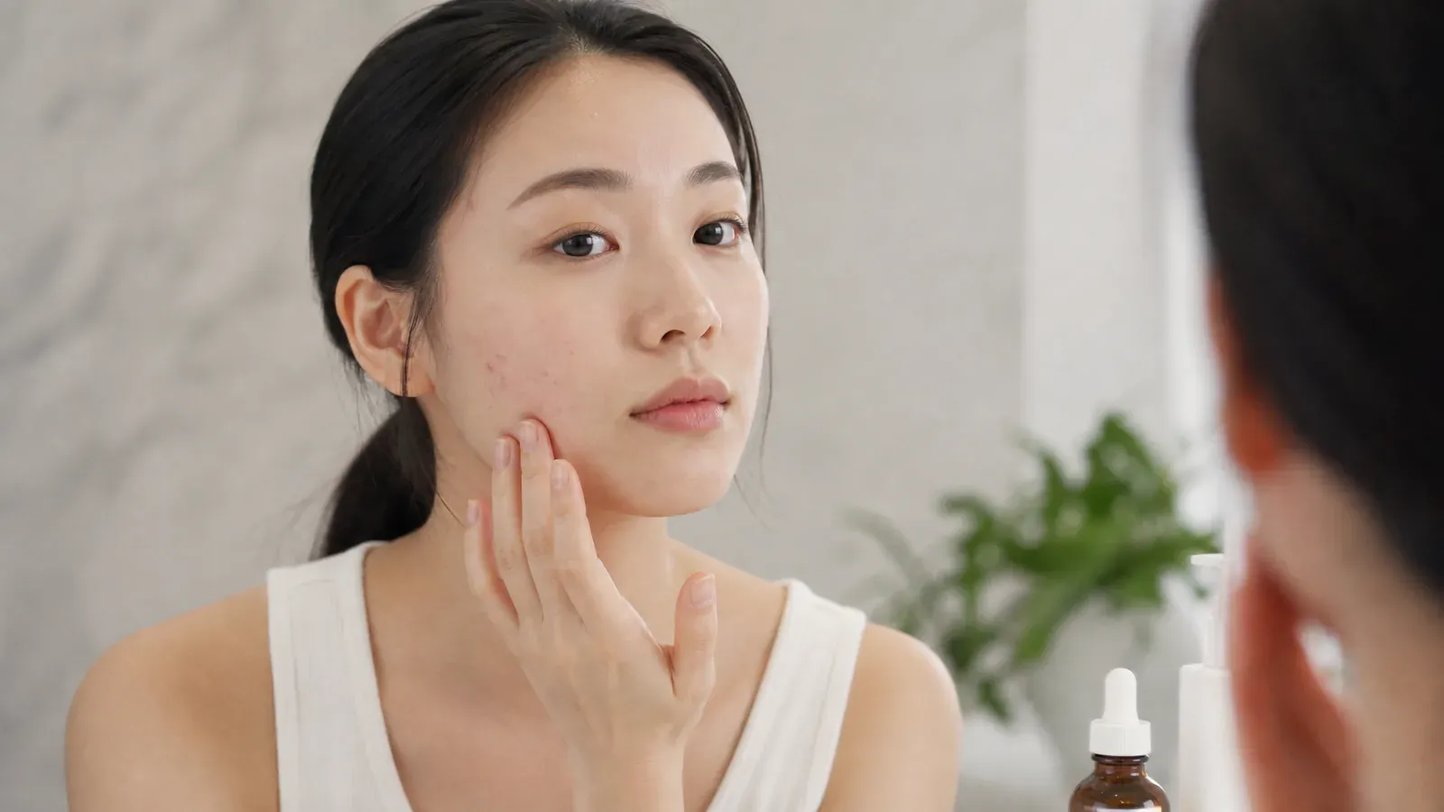 「發揮視黃醇的力量:加強青春痘治療效果的指南」的專題圖片