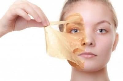 chemical peel