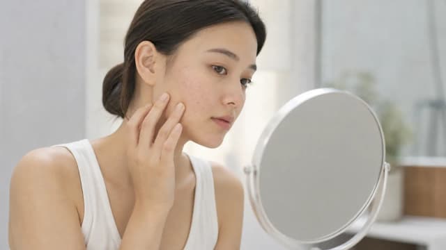 Editorial image for No Need for Oral A-Retinoids: Morpheus8 Microneedling RF Helps You Effectively Combat Acne