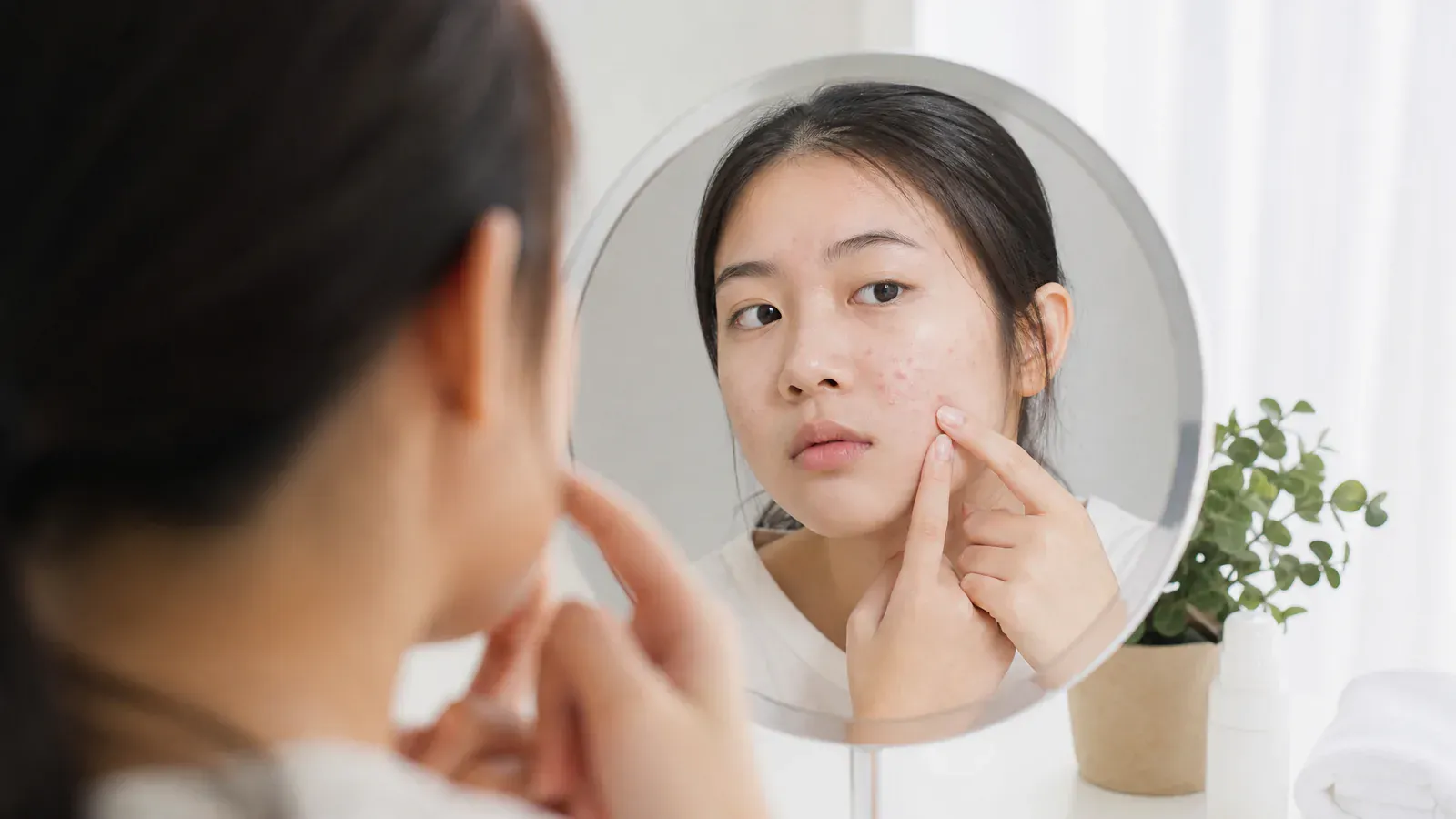 Editorial image for Secrets to Skincare during Puberty: Two Key Tips to Help You Overcome Acne Troubles