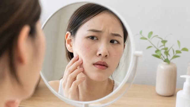 Editorial image for Skin Crisis! How to Deal with the Troubles of Demodex Mites