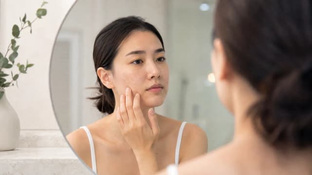 Editorial image for The Charm of Medium Depth Peels: Solutions for Acne and Hormonal Spots