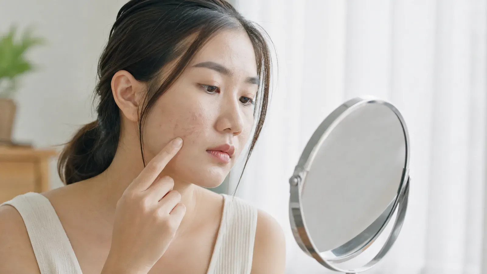 「早期治療暗瘡疤痕的重要性:讓皮膚回歸光滑」的專題圖片