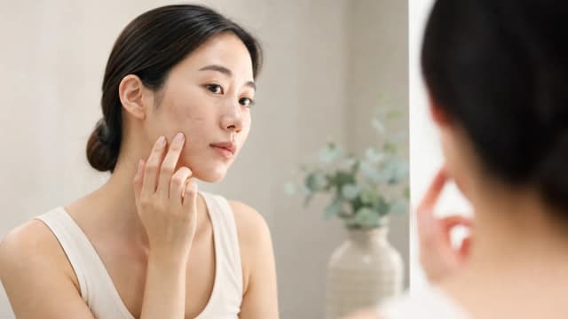 Editorial image for The Solution to Acne Scars: New Hope from Filling Treatments