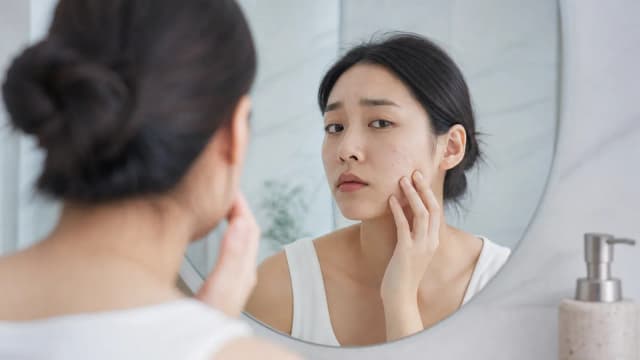 Editorial image for Three Major Secrets to Fighting Acne in Daily Life
